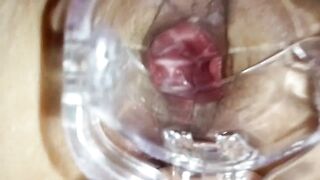 stepsister let me play dr with speculum to see her making grool inside