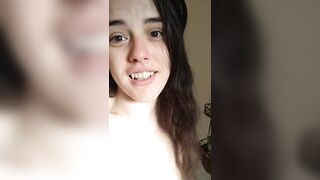 PIMPLE POPPING! Spontaneously Orgasming Crazy Camgirl PinkMoonLust Pops Pimples Face & Talks Orgasm