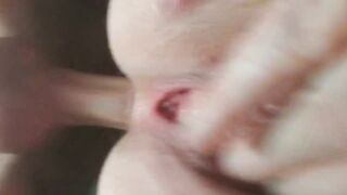 Anal close up
